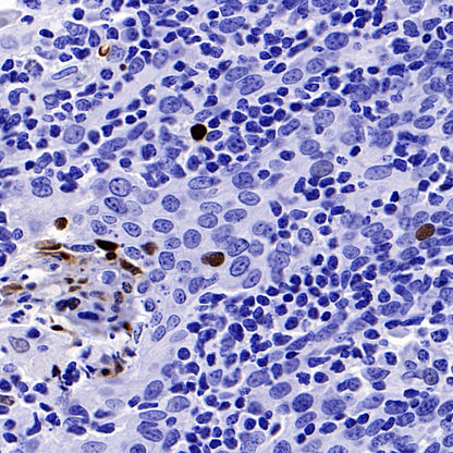 Phospho-DNA-PKcs (Ser2056) Recombinant Rabbit mAb (S-3813)