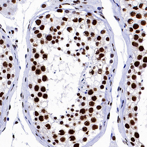 hnRNP H Rabbit Polyclonal Antibody