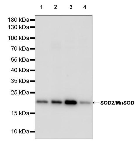 SOD2/MnSOD Rabbit Polyclonal Antibody