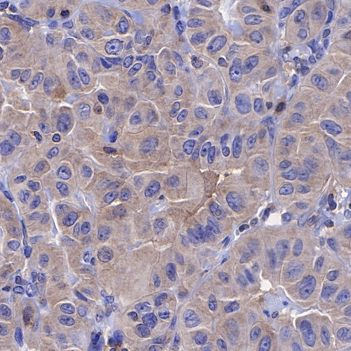 STIP1 Recombinant Rabbit mAb (S-680-39)