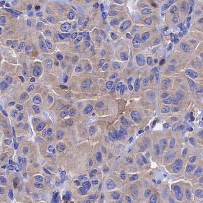 STIP1 Recombinant Rabbit mAb (S-680-39)