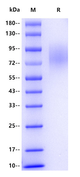 LAMP1 His Tag Protein, Human