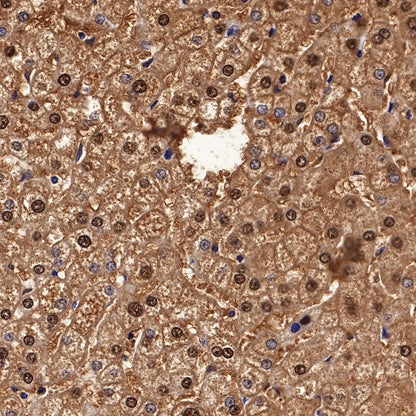 Arginase-1 Recombinant Rabbit mAb (SDT-369-33)