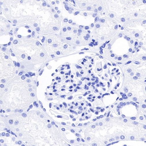 Inhibin alpha Recombinant Rabbit mAb (SDT-R307)