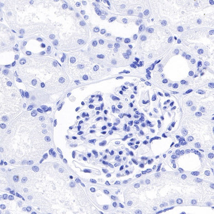 Inhibin alpha Recombinant Rabbit mAb (SDT-R307)