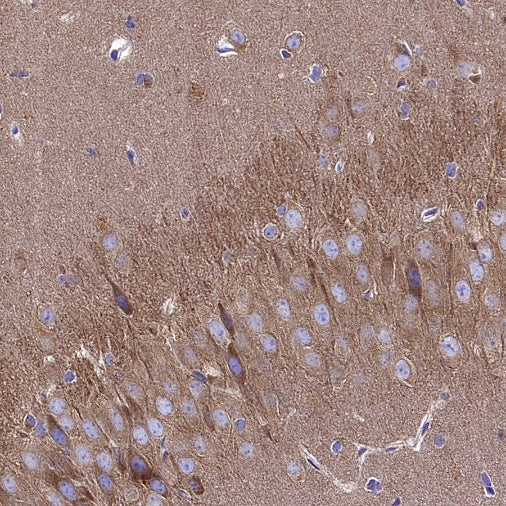 ADRB2 Recombinant Rabbit mAb (S-2418-144)