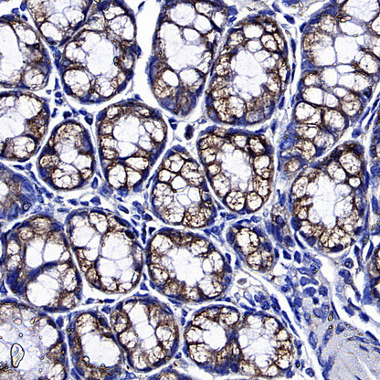 Golgin-245 Recombinant Rabbit mAb (S-4473-8)