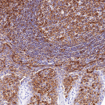 CD99 Recombinant Rabbit mAb (SDT-R122)