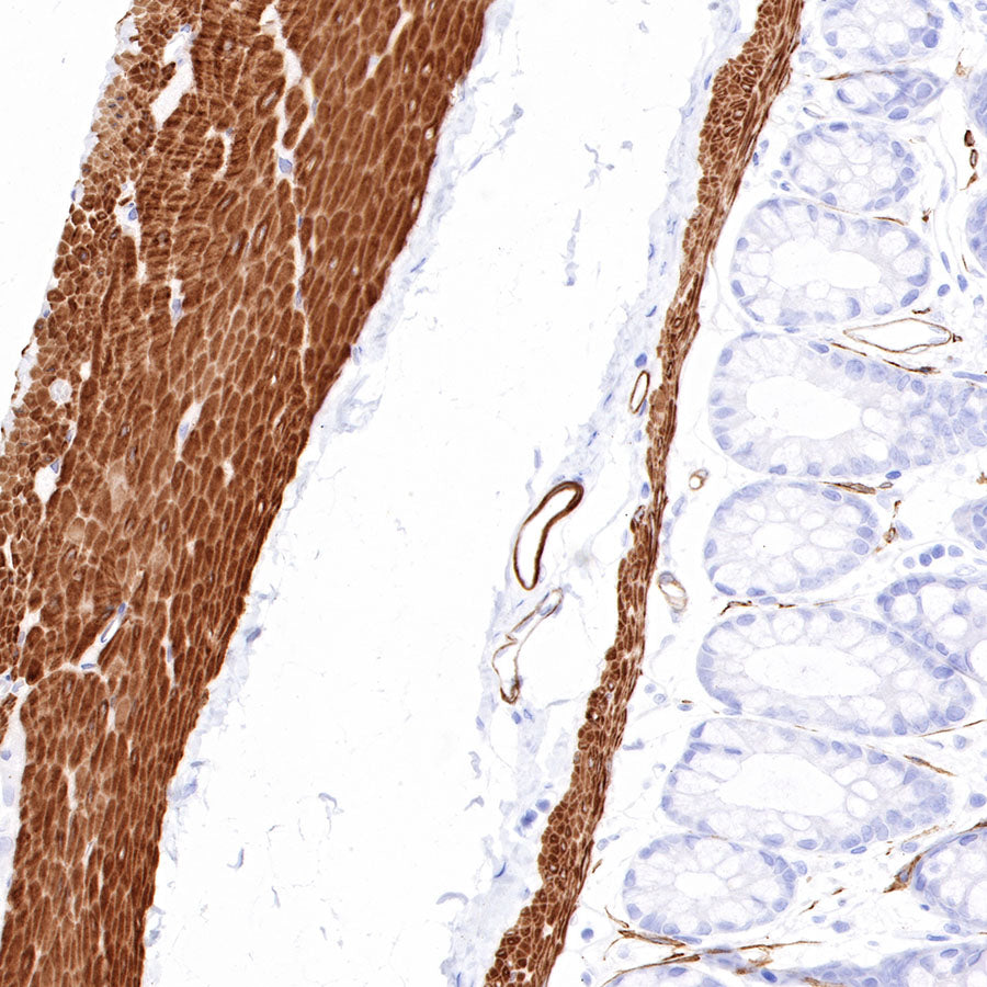 Smooth Muscle Myosin Heavy Chain (SMMHC) Recombinant Rabbit mAb (SDT-R089)
