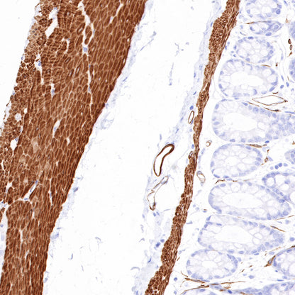 Smooth Muscle Myosin Heavy Chain (SMMHC) Recombinant Rabbit mAb (SDT-R089)