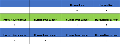 AGXT Recombinant Rabbit mAb (S-3586-30)