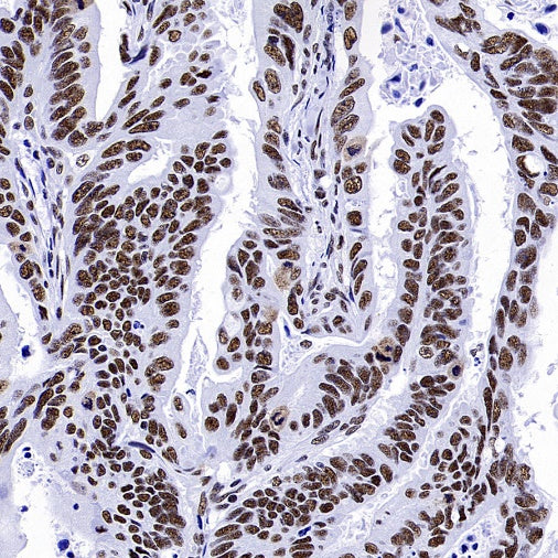 WTAP Recombinant Rabbit mAb (S-2741-49)