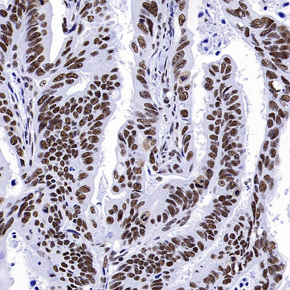 WTAP Recombinant Rabbit mAb (S-2741-49)