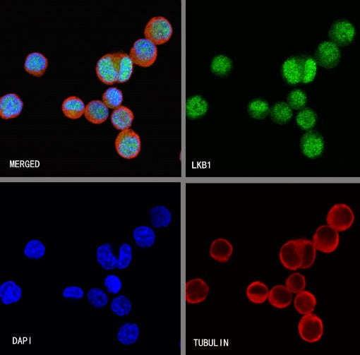 LKB1 Recombinant Rabbit mAb (S-1264-31)