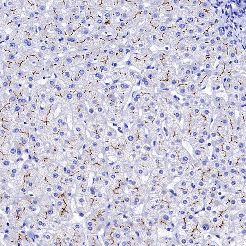 MRP2 Recombinant Rabbit mAb (S-2316-41)