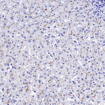 MRP2 Recombinant Rabbit mAb (S-2316-41)