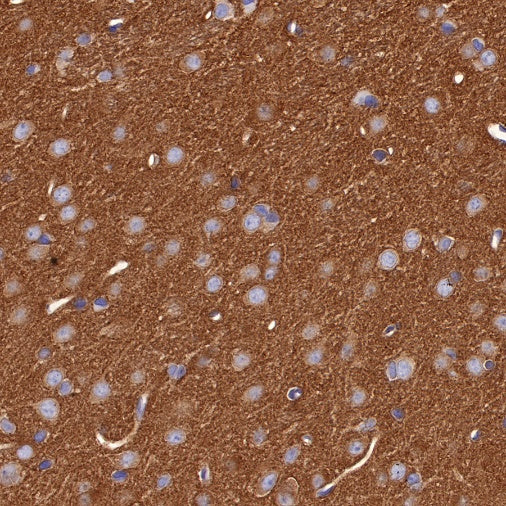 Non-muscle Myosin IIB/MYH10 Recombinant Rabbit mAb (S-299-3)