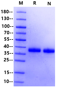 Biotinylated Prolactin R/PRLR His&Avi Tag Protein, Human