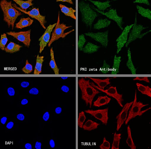 PKC zeta Recombinant Rabbit mAb (S-1306-34)