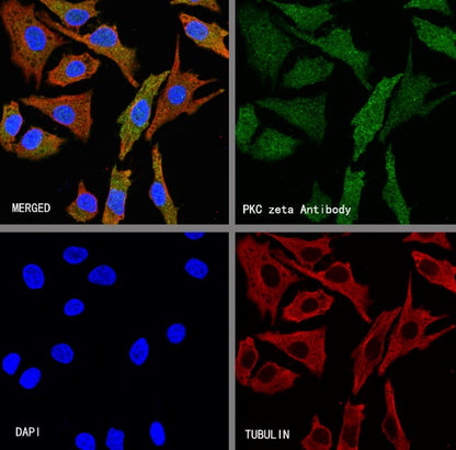 PKC zeta Recombinant Rabbit mAb (S-1306-34)