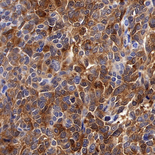 PTP1B Recombinant Rabbit mAb (S-R304)