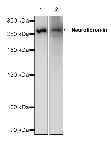 Neurofibromin Recombinant Rabbit mAb (S-3540-15)