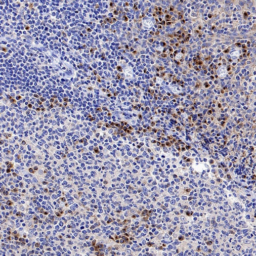 SEC23B Recombinant Rabbit mAb (S-1935-28)
