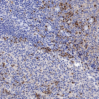 SEC23B Recombinant Rabbit mAb (S-1935-28)