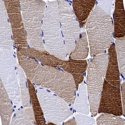 AQP4 Recombinant Rabbit mAb (S-1609-62)
