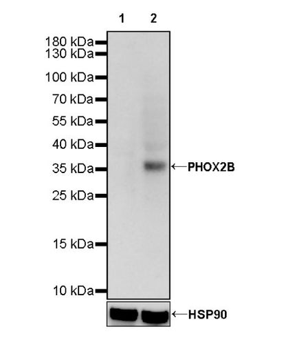 PHOX2B Recombinant Rabbit mAb (SDT-1142-21)