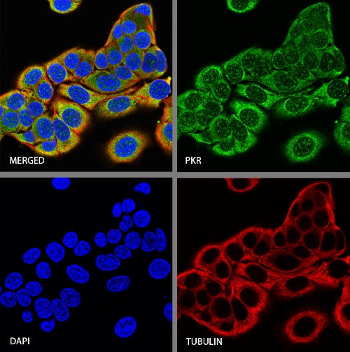PKR Recombinant Rabbit mAb (S-731-118)