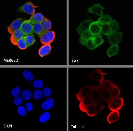 FAK Recombinant Rabbit mAb (S-1180-10)
