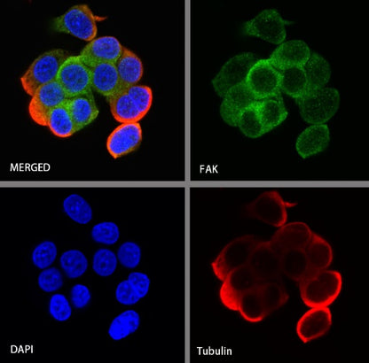 FAK Recombinant Rabbit mAb (S-1180-10)