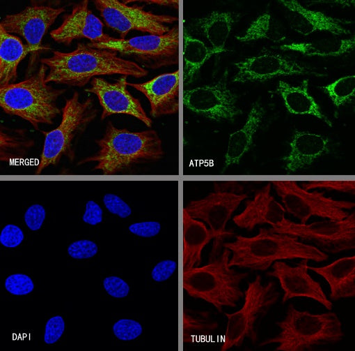 ATP5B Recombinant Rabbit mAb (S-1271-29)