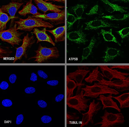 ATP5B Recombinant Rabbit mAb (S-1271-29)