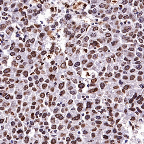 Histone H3 Recombinant Rabbit mAb (SDT-266-44)