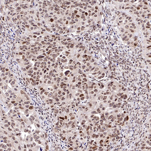 FOXM1 Recombinant Rabbit mAb (S-2529-26)
