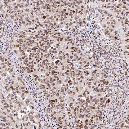 FOXM1 Recombinant Rabbit mAb (S-2529-26)
