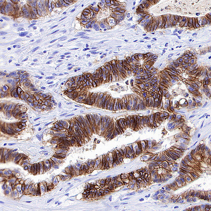 CDH17 Recombinant Rabbit mAb (SDT-3276-11)