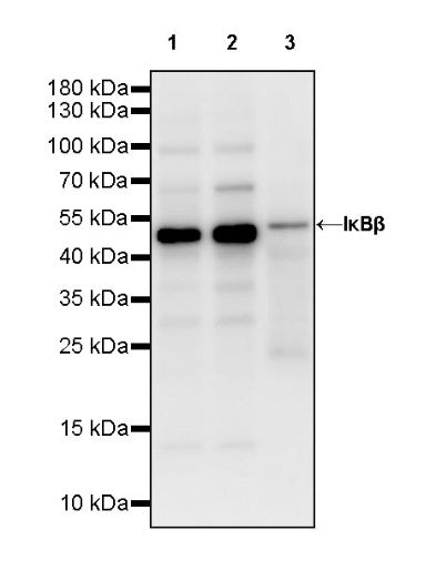 IκBβ Recombinant Rabbit mAb (S-810-203)