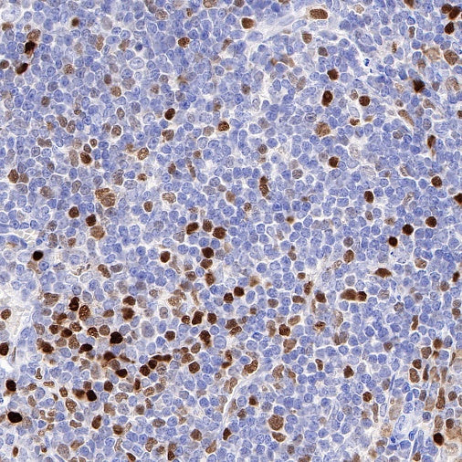 T-bet/TBX21 Recombinant Rabbit mAb (S-583-54)