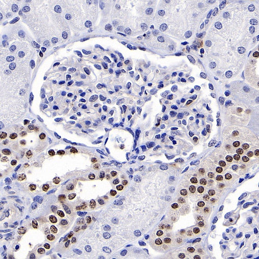 TFEB Recombinant Rabbit mAb (S-R296)