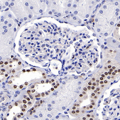 TFEB Recombinant Rabbit mAb (S-R296)