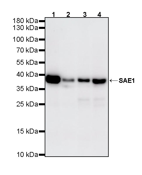 SAE1 Rabbit Polyclonal Antibody