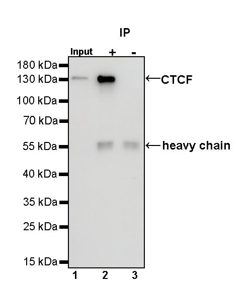 CTCF Recombinant Rabbit mAb (S-924-14)