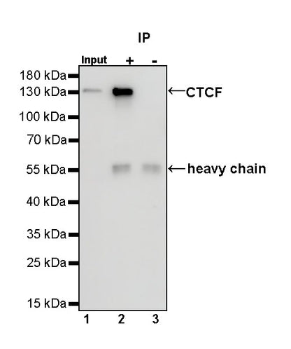 CTCF Recombinant Rabbit mAb (S-924-14)