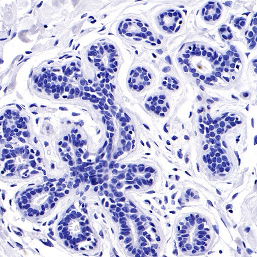 PEG10 Recombinant Rabbit mAb (SDT-442-60)