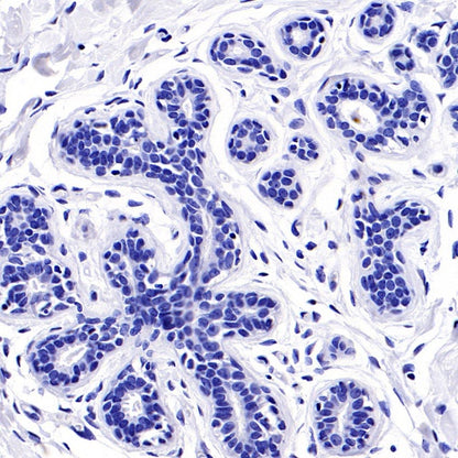 PEG10 Recombinant Rabbit mAb (SDT-442-60)