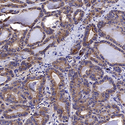 CD61 Recombinant Rabbit mAb (S-2515-6)