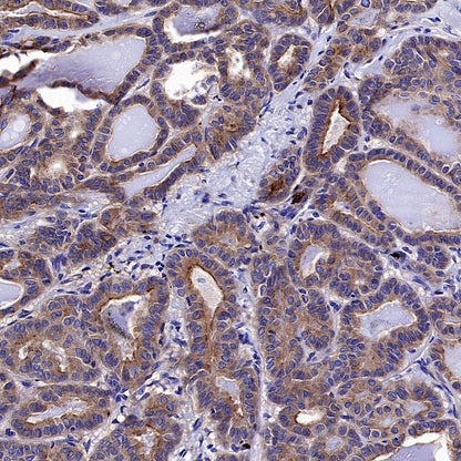 CD61 Recombinant Rabbit mAb (S-2515-6)
